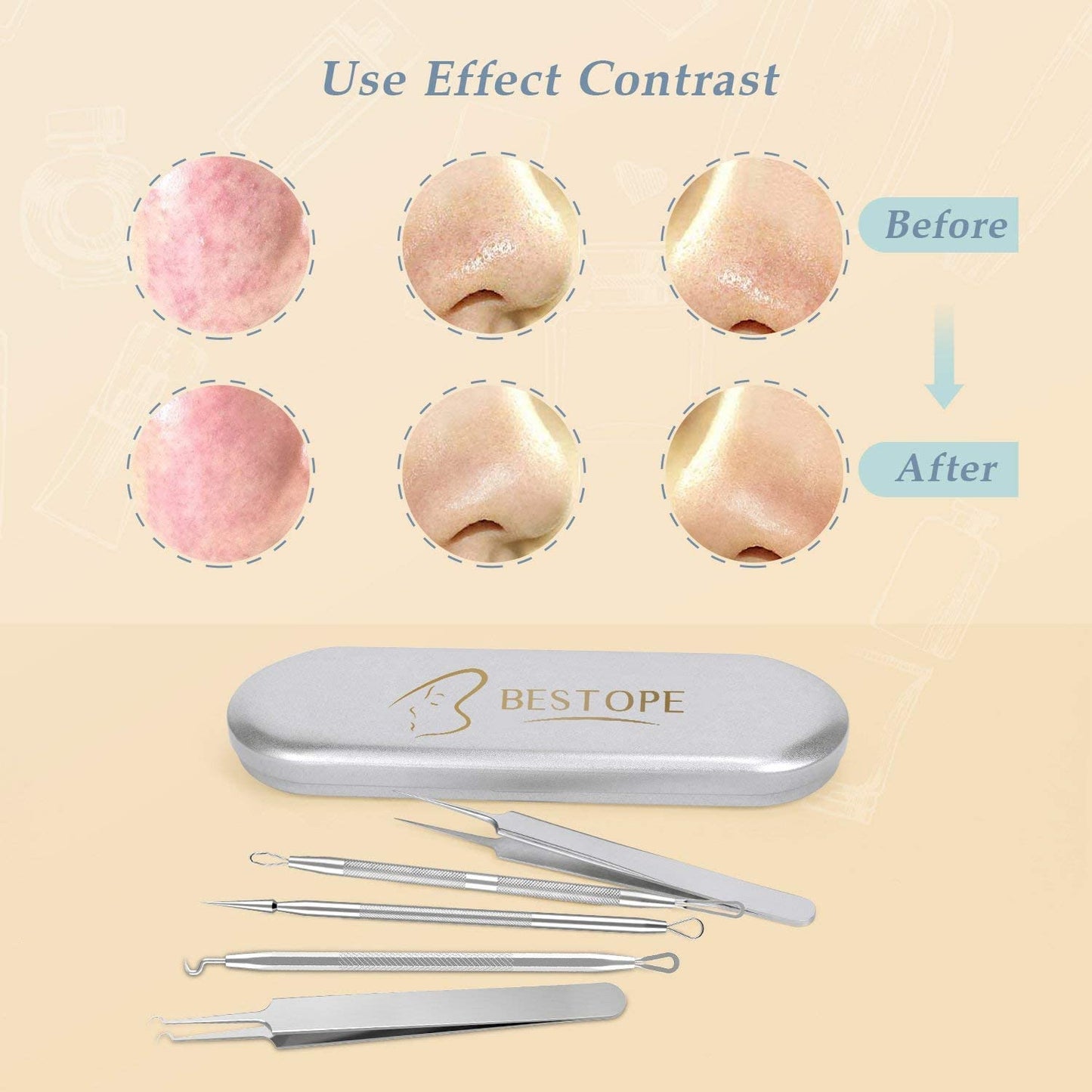 🧼 مجموعة أدوات إزالة الرؤوس السوداء 5 قطع – تنظيف احترافي في علبة معدنية !