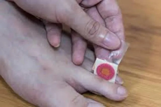 لصقات مسامير اللحم عدد 5 ضمادات طبية لعلاج جروح القدم