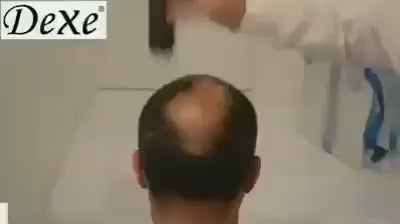 تحميل الفيديو: 